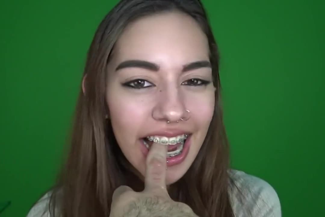 Braces BabyDoll Bites The Hand That Fucks Her_main_thumbnail